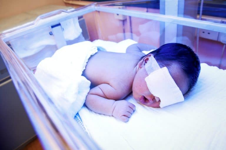 Newborn baby with jaundice under ultraviolet light treatment in an incubator.
