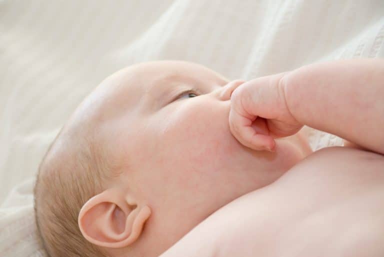 Різні плями та утворення на шкірі у новонароджених дітей